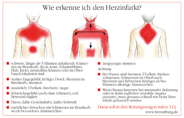 Die Deutsche Herzstiftung hat Anzeichen und Beschwerden, die auf einen Herzinfarkt hindeuten können, zusammengefasst. Diese Symptome nicht zu unterschätzen, kann Leben retten. Foto: www.herzstiftung.de